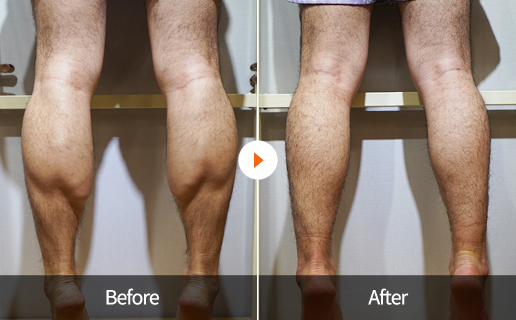 Before&After
