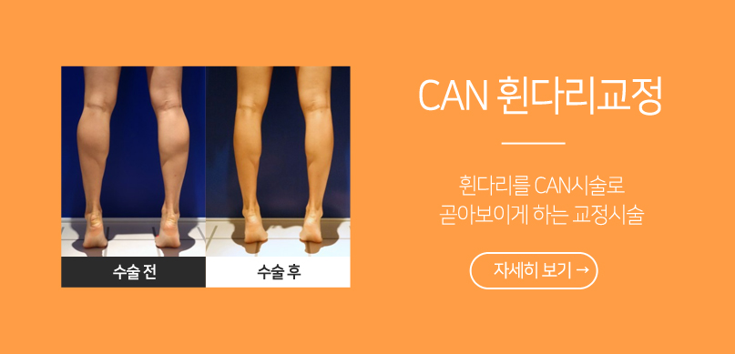 CAN 휜다리교정